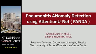 Technical Talk Predicting Immune Checkpoint Inhibitor Pneumonitis in Lung Cancer Patients Using [upl. by Savitt]