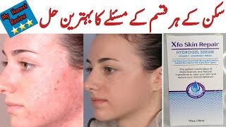 خراب سے خراب سکن کو دنوں میں ٹھیک کرو Xfo Skin Repair Serum [upl. by Ahseit498]