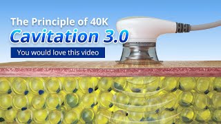 The Principle Of 40K Cavitation 30 The Most Advanced Technology Ever CAVITATION WEIGHTLOSS [upl. by Clara]