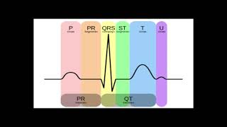 Aprender electrocardiograma básico 11 2021 [upl. by Zirtaeb]