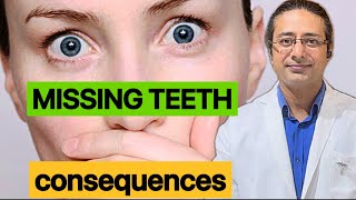 How to identify missing teeth problemsDisadvantages of missing teeth [upl. by Stalder]