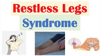 Restless Legs Syndrome RLS  Causes Signs amp Symptoms Diagnosis Treatment [upl. by Limann]