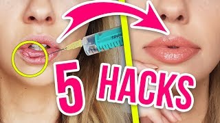 LIPPEN SELBER AUFSPRITZEN 😱 5 HACKS für volle LIPPEN die jeder zu Hause nachmachen kann [upl. by Milman719]