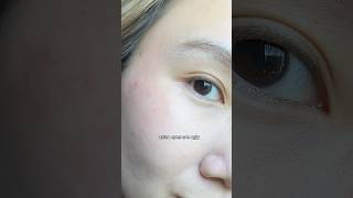 asian eyes are ugly 🥲 👁️ skincare eyes contactlenses canada [upl. by Fabi]