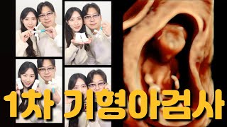 니프티 검사 비용💰ㅣ갑상선 수치 이슈ㅣ결국 입덧약 처방💊ㅣ12주차 배 크기 기록 🤰🏻 [upl. by Siraval]