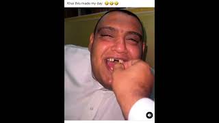 Funny video 😂😂😂 teeth dentures justforfun [upl. by Daphna]