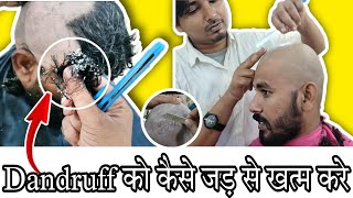 How to full Dandruff Removal😱🪒 Headshaveasmr headshave Most attractive dandruff HeadShave tutorial [upl. by Warton]