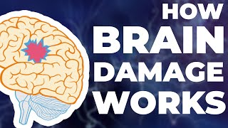 How Brain Damage Works [upl. by Ecirb783]