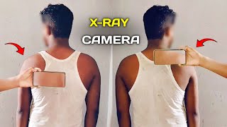 xray camera body scanner app  body scanner [upl. by Kravits652]