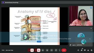 Prolapsed Intervertebral Disc Anatomy of IV Disc [upl. by Anitsyrc]