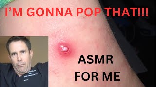 Why Do People Enjoy Watching Pimple Popping DONT LAUGH [upl. by Tager305]