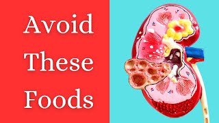 High oxalate foods  High Oxalate Foods List  Foods to avoid for kidney stones  Body Brief [upl. by Middendorf247]