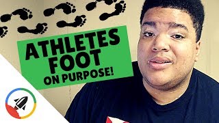 How To Get Athletes Foot ON PURPOSE [upl. by Hillard]