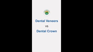 Front Teeth Crowns vs Veneers Simplified [upl. by Fawna814]