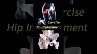 Hip Impingement Groin Pain or Rubbing Hip Stiffness FAI femoroacetabular [upl. by Plank375]