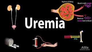 Uremia Pathophysiology Symptoms Diagnosis and Treatment Animation [upl. by Oberheim]