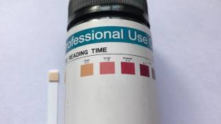 How to read ketone test strip results What are normal ketone levels [upl. by Yragerg]