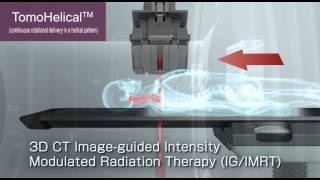 TomoTherapy® H series [upl. by Viridissa]