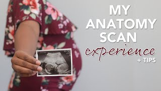 20 Week Anatomy Scan What to Expect  Tips [upl. by Nojid726]