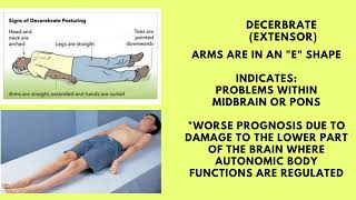 TBI Posturing Decerebrate vs Decorticate [upl. by Tufts695]