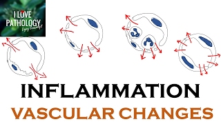 INFLAMMATION Part 1 General concepts types  Vascular changes in Acute inflammation [upl. by Koal397]