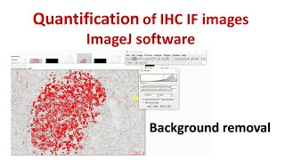 Quantification of Immunohistochemistry images using ImageJ  How to remove background in ImageJ [upl. by Ignacio]