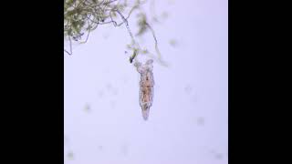 Rotifers in stagnant freshwater through Microscope [upl. by Karlotta919]