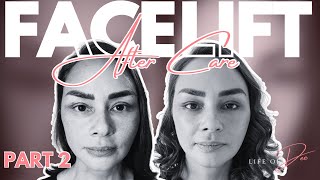 Ang Facelift Journey ni Donita Rose Part 2  Life Of Dee Ep 5 [upl. by Llenol]