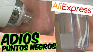 😲 ¡NUEVO EXTRACTOR DE PUNTOS NEGROS 20 de ALIEXPRESS 😱¿Funciona ¿Merece la pena [upl. by Nagy]