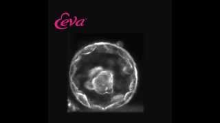 Embryo Development Day 5 Using The Eeva Test [upl. by Etteniuqna857]