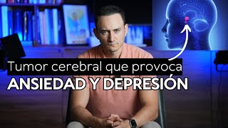 Vivió con Ansiedad y Depresión por 16 años y resultó ser un tumor en el cerebro [upl. by Meisel]