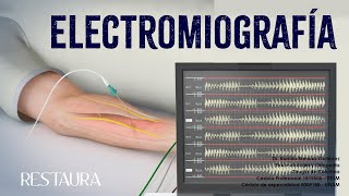 ¿Qué es la electromiografía [upl. by Drolet]