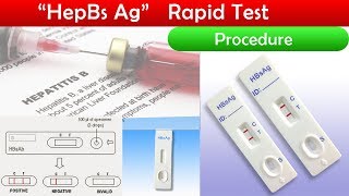 HepBs Ag test Procedure  clear explain [upl. by Namaan]