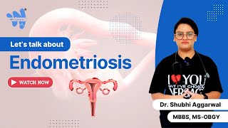 Endometriosis  Causes Symptoms amp Treatment [upl. by Jilleen]