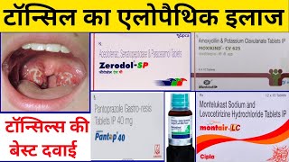 Treatment of Tonsillitis  Tonsillitis treatment in hindi  tonsils treatment in hindi [upl. by Laveen]