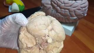 Anatomy of Cerebellum  Lab Demo  Dr Yusuf [upl. by Edwina477]