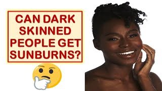 The TRUTH About Sunburns🌞🔥 [upl. by Ilhsa]