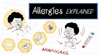 What are Allergies HealthSketch [upl. by Asnarepse]