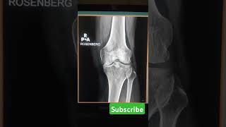 Rosenberg view xray support subscribe ytviralvideo youtubeshort xraytech [upl. by Marie-Ann265]