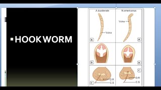 Parasitology 200 a Hookwormancylostoma duodenalenecator americanus [upl. by Herzen]