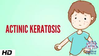 Actinic keratosis Causes Signs and Symptoms Diagnosis and Treatment [upl. by Januarius310]