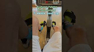 Completely Ruptured Patellar Knee Cap Tendon Recovery 7 Weeks Post Op Knee Reconstruction  PT [upl. by Eltsirk587]