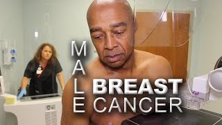 Men and Mammography  Early Detection of Male Breast Cancer [upl. by Esilanna929]