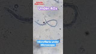 Microfilaria under microscope 🪱🪱 medical laboratory [upl. by Terrill]