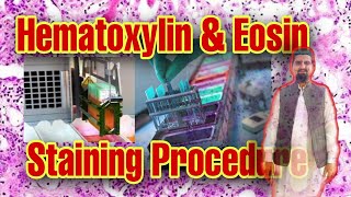 Performing routine Hematoxylin amp Eosin stainingHistopathology Lab [upl. by Noonan]