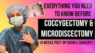 EVERYTHING YOU NEED TO KNOW  Double Surgery Coccygectomy amp Microdiscectomy  4 Weeks PostOp [upl. by Stan738]