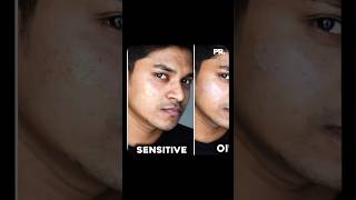 Best Face Moisturizer for Oily Dry Combination amp Sensitive Skin  Heres Why You Need It shorts [upl. by Adlez]