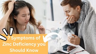 7 Symptoms Of Zinc Deficiency You Must Know [upl. by Aural216]