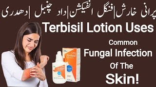 Terbisil Lotion 20ml Uses In Urdu Terbinafine Lotion Benefits  Terbisil Tablet 125mg 250mg  ami [upl. by Navi480]