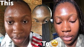 The ordinary glycolic acid 7 toning solution  2 months review with before and after [upl. by Chaing]